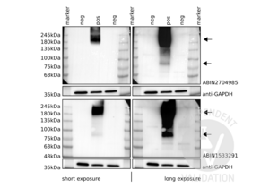 Western Blotting validation image for anti-Glutamate Receptor, Metabotropic 6 (GRM6) (C-Term) antibody (ABIN2704985) (Metabotropic Glutamate Receptor 6 Antikörper  (C-Term))