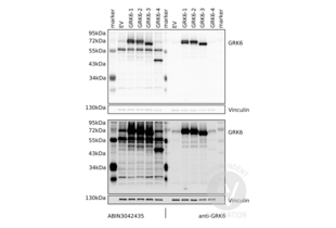 Western Blotting validation image for anti-G Protein-Coupled Receptor Kinase 6 (GRK6) (AA 382-417), (C-Term) antibody (ABIN3042435) (GRK6 Antikörper  (C-Term))