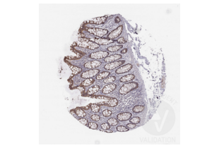 Immunohistochemistry validation image for anti-Hepatitis A Virus Cellular Receptor 1 (HAVCR1) (AA 332-348), (C-Term) antibody (ABIN3044226) (HAVCR1 Antikörper  (C-Term))