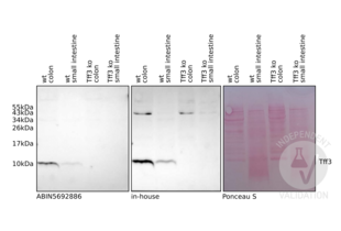 Western Blotting validation image for anti-Trefoil Factor 3 (Intestinal) (TFF3) (AA 23-81) antibody (ABIN5692886) (TFF3 Antikörper  (AA 23-81))