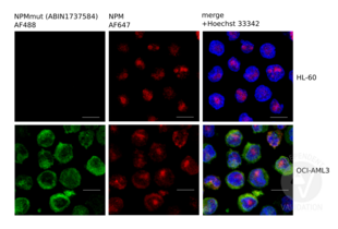Immunofluorescence validation image for anti-Nucleophosmin (Nucleolar phosphoprotein B23, Numatrin) (NPM1) (AA 250-298), (C-Term) antibody (ABIN1737584) (NPM1 Antikörper  (C-Term))