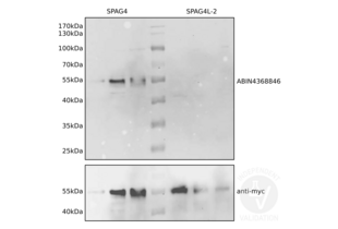 Western Blotting validation image for anti-Sperm Associated Antigen 4 (SPAG4) antibody (ABIN4368846) (SPAG4 Antikörper)