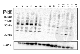 Western Blotting validation image for anti-Complement Component C9 (C9) (AA 191-220), (Center) antibody (ABIN657704) (C9 Antikörper  (Center))