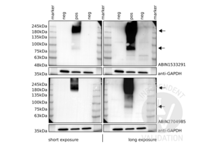 Western Blotting validation image for anti-Glutamate Receptor, Metabotropic 6 (GRM6) (AA 828-877) antibody (ABIN1533291) (Metabotropic Glutamate Receptor 6 Antikörper  (AA 828-877))
