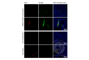Immunofluorescence validation image for anti-Glutamate Receptor, Metabotropic 6 (GRM6) (AA 828-877) antibody (ABIN1533291) (Metabotropic Glutamate Receptor 6 Antikörper  (AA 828-877))
