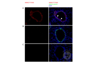 Immunofluorescence validation image for anti-Cytochrome P450, Family 4, Subfamily B, Polypeptide 1 (CYP4B1) (N-Term) antibody (ABIN2777006) (CYP4B1 Antikörper  (N-Term))
