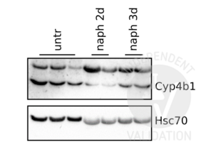 Western Blotting validation image for anti-Cytochrome P450, Family 4, Subfamily B, Polypeptide 1 (CYP4B1) (N-Term) antibody (ABIN2777006) (CYP4B1 Antikörper  (N-Term))