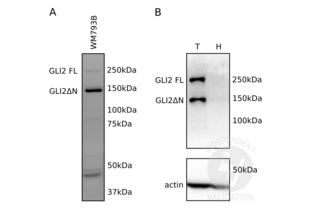 Western Blotting validation image for anti-GLI Family Zinc Finger 2 (GLI2) (Middle Region) antibody (ABIN2777474) (GLI2 Antikörper  (Middle Region))