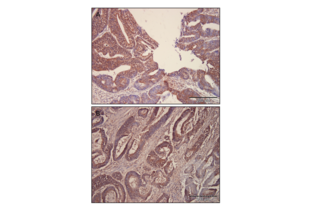 Immunohistochemistry validation image for anti-GLI Family Zinc Finger 2 (GLI2) (Middle Region) antibody (ABIN2777474) (GLI2 Antikörper  (Middle Region))