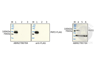 Western Blotting validation image for anti-Plakophilin 2 (PKP2) (N-Term) antibody (ABIN2786784) (Plakophilin 2 Antikörper  (N-Term))
