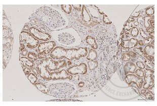 Immunohistochemistry validation image for anti-Aquaporin 2 (Collecting Duct) (AQP2) (AA 171-271) antibody (ABIN707576) (AQP2 Antikörper  (AA 171-271))