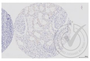 Immunohistochemistry validation image for anti-Aquaporin 2 (Collecting Duct) (AQP2) (AA 171-271) antibody (ABIN707576) (AQP2 Antikörper  (AA 171-271))