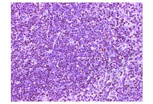 Immunohistochemistry validation image for anti-CD4 (CD4) (AA 385-457) antibody (ABIN671376) (CD4 Antikörper  (AA 385-457))