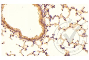 Immunohistochemistry validation image for anti-Coagulation Factor III (thromboplastin, Tissue Factor) (F3) (AA 32-100) antibody (ABIN708086) (Tissue factor Antikörper  (AA 32-100))