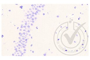Immunohistochemistry validation image for anti-Coagulation Factor III (thromboplastin, Tissue Factor) (F3) (AA 32-100) antibody (ABIN708086) (Tissue factor Antikörper  (AA 32-100))