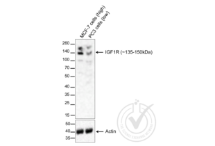 Western Blotting validation image for anti-Insulin-Like Growth Factor 1 Receptor (IGF1R) (AA 251-350) antibody (ABIN726575) (IGF1R Antikörper  (AA 251-350))