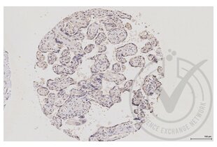 Immunohistochemistry validation image for anti-Mitogen-Activated Protein Kinase 14 (MAPK14) (pThr180), (pTyr182) antibody (ABIN678668) (MAPK14 Antikörper  (pThr180, pTyr182))