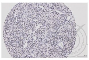 Immunohistochemistry validation image for anti-Mitogen-Activated Protein Kinase 14 (MAPK14) (pThr180), (pTyr182) antibody (ABIN678668) (MAPK14 Antikörper  (pThr180, pTyr182))