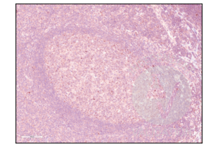 Immunohistochemistry validation image for anti-Programmed Cell Death 1 (PDCD1) (AA 201-288) antibody (ABIN735608) (PD-1 Antikörper  (AA 201-288))