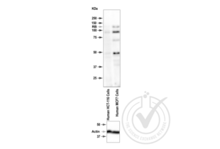 Western Blotting validation image for anti-Retinoblastoma 1 (RB1) (pSer795) antibody (ABIN712946) (Retinoblastoma 1 Antikörper  (pSer795))