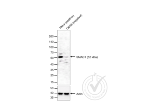 Western Blotting validation image for anti-Smad1/5 Protein (SMAD1/5) (AA 361-465) antibody (ABIN732158) (Smad1/5 Antikörper  (AA 361-465))