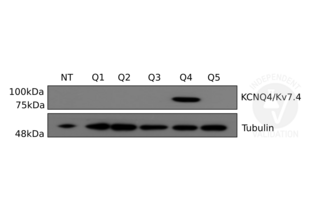 Western Blotting validation image for anti-Potassium Voltage-Gated Channel, KQT-Like Subfamily, Member 4 (KCNQ4) antibody (ABIN1304779) (KCNQ4 Antikörper)