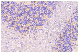 Immunohistochemistry validation image for anti-Clathrin (AA 4-171) antibody (ABIN968006) (Clathrin Antikörper  (AA 4-171))