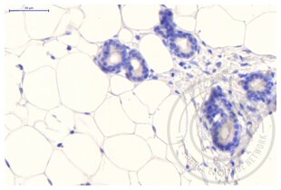 Immunohistochemistry validation image for anti-Clathrin (AA 4-171) antibody (ABIN968006) (Clathrin Antikörper  (AA 4-171))