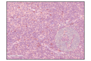 Immunohistochemistry validation image for anti-CD84 (CD84) (Internal Region) antibody (ABIN3187786) (CD84 Antikörper  (Internal Region))