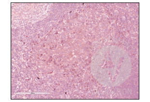 Immunohistochemistry validation image for anti-CD84 (CD84) (Internal Region) antibody (ABIN3187786) (CD84 Antikörper  (Internal Region))