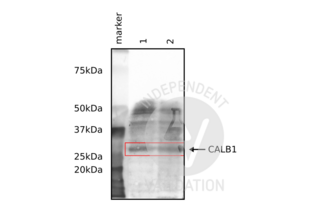 Western Blotting validation image for anti-Calbindin (CALB1) antibody (ABIN6254097) (CALB1 Antikörper)
