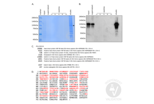 Immunoprecipitation validation image for anti-Catenin (Cadherin-Associated Protein), beta 1, 88kDa (CTNNB1) antibody (Magnetic Particles) (ABIN1690141) (CTNNB1 Antikörper  (Magnetic Particles))