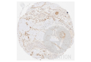 Immunohistochemistry validation image for anti-Collagen, Type III (COL3) antibody (ABIN5596830) (COL3 Antikörper)