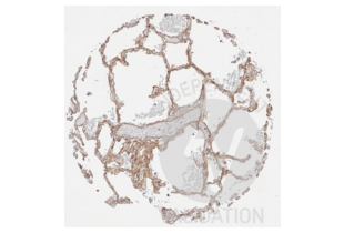 Immunohistochemistry validation image for anti-Collagen, Type IV (COL4) antibody (ABIN5596835)