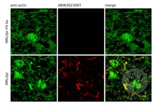 Immunofluorescence validation image for anti-Complement Factor H (CFH) (AA 20-270) antibody (ABIN3023097) (Complement Factor H Antikörper  (AA 20-270))