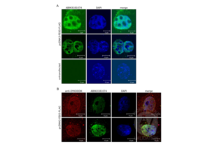 Immunocytochemistry validation image for anti-DYKDDDDK Tag antibody (ABIN3181074) (DYKDDDDK Tag Antikörper)