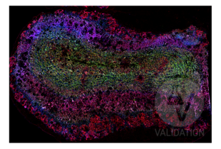 Multiplex Immunohistochemistry validation image for anti-Discs, Large Homolog 4 (Drosophila) (DLG4) antibody (ABIN361694) (DLG4 Antikörper)