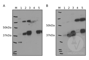 Western Blotting validation image for anti-Ectonucleoside Triphosphate diphosphohydrolase 5 (ENTPD5) (Center) antibody (ABIN2856876) (ENTPD5 Antikörper  (Center))