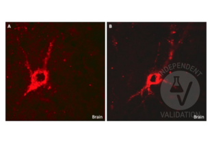 Immunohistochemistry validation image for anti-Glutamate Decarboxylase 1 (Brain, 67kDa) (GAD1) (C-Term) antibody (ABIN3184725) (GAD Antikörper  (C-Term))