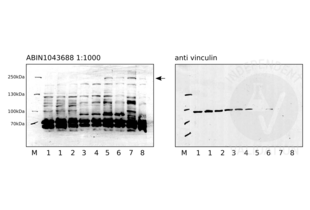Western Blotting validation image for anti-Notch 2 (NOTCH2) (N-Term) antibody (ABIN1043688) (NOTCH2 Antikörper  (N-Term))