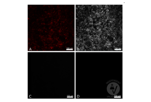Immunofluorescence validation image for anti-Red Fluorescent Protein (RFP) antibody (ABIN1043867) (RFP Antikörper)