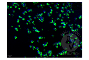 Multiplex Immunohistochemistry validation image for anti-SARS-CoV-2 Spike S1 (RBD) antibody (ABIN6952546) (Rekombinanter SARS-CoV-2 Spike S1 Antikörper  (RBD))