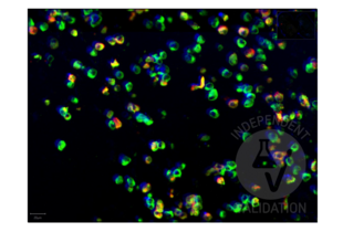 Multiplex Immunohistochemistry validation image for anti-SARS-CoV-2 Spike S1 (RBD) antibody (ABIN6952546) (Rekombinanter SARS-CoV-2 Spike S1 Antikörper  (RBD))