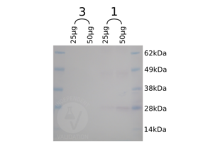 Western Blotting validation image for anti-SNAP Tag antibody (ABIN1573927) (SNAP Tag Antikörper)