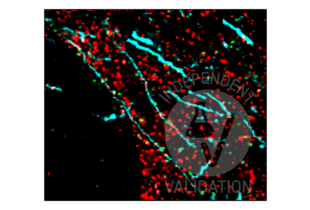 Multiplex Immunohistochemistry validation image for anti-Synapsin I (SYN1) (AA 362-511) antibody (ABIN5542390) (SYN1 Antikörper  (AA 362-511))