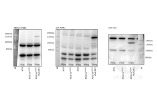 Western Blotting validation image for anti-alpha-Kinase 1 (ALPK1) (N-Term) antibody (ABIN3187581) (ALPK1 Antikörper  (N-Term))