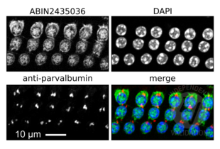 Immunofluorescence validation image for anti-Myosin VIIA (MYO7A) antibody (ABIN2435036) (Myosin VIIA Antikörper)