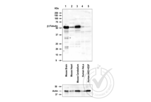Western Blotting validation image for anti-Tubulin, beta 3 (TUBB3) (AA 443-450) antibody (ABIN1742553) (TUBB3 Antikörper  (AA 443-450))