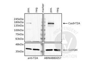 Western Blotting validation image for anti-CRISPR-Cas9 (N-Term) antibody (ABIN4880057) (CRISPR-Cas9 (N-Term) Antikörper)