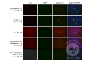 Immunofluorescence validation image for anti-CRISPR-Cas9 (N-Term) antibody (ABIN4880057) (CRISPR-Cas9 (N-Term) Antikörper)